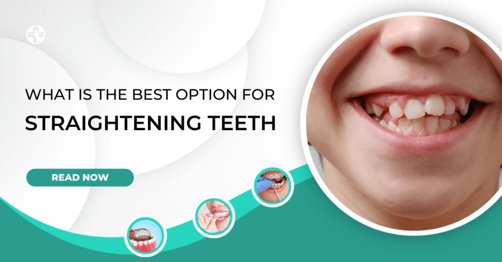 What is the Best Option for Straightening Teeth