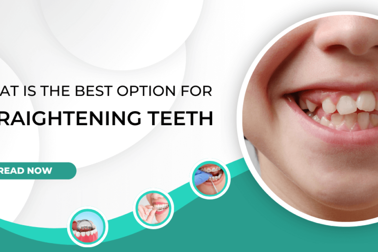 What is the Best Option for Straightening Teeth