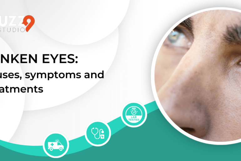 Sunken Eyes: Causes, symptoms and Treatments